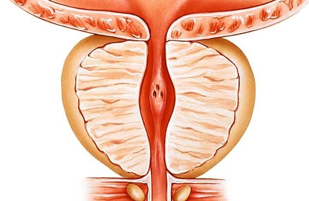 Prostatită